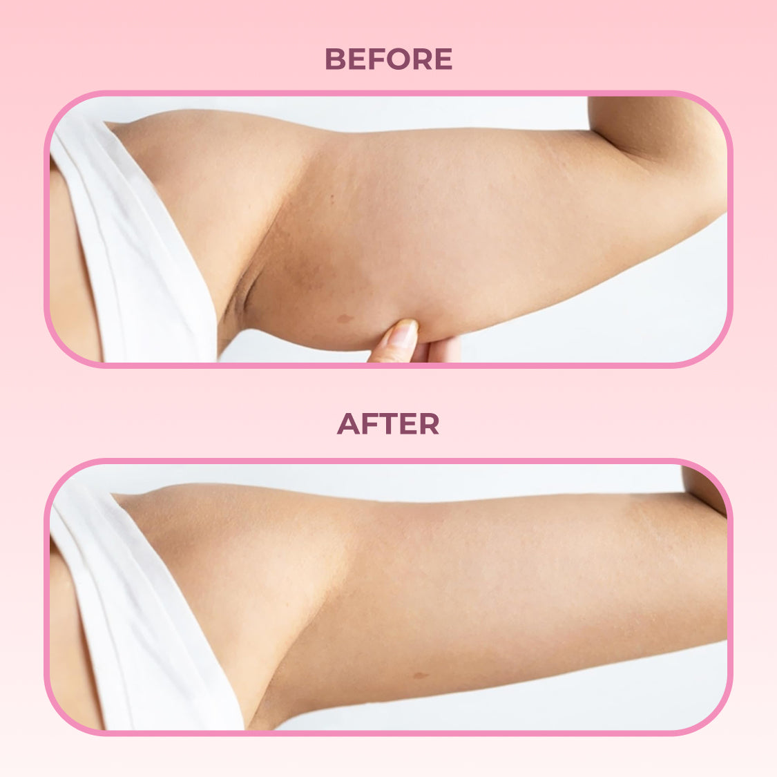 Firming Arm Cream