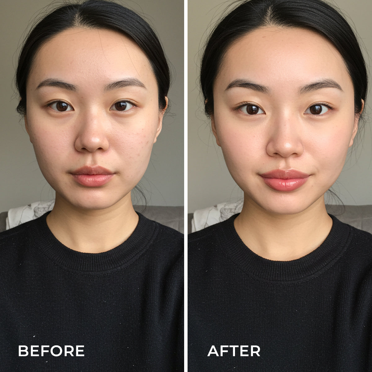 Lip Plumper