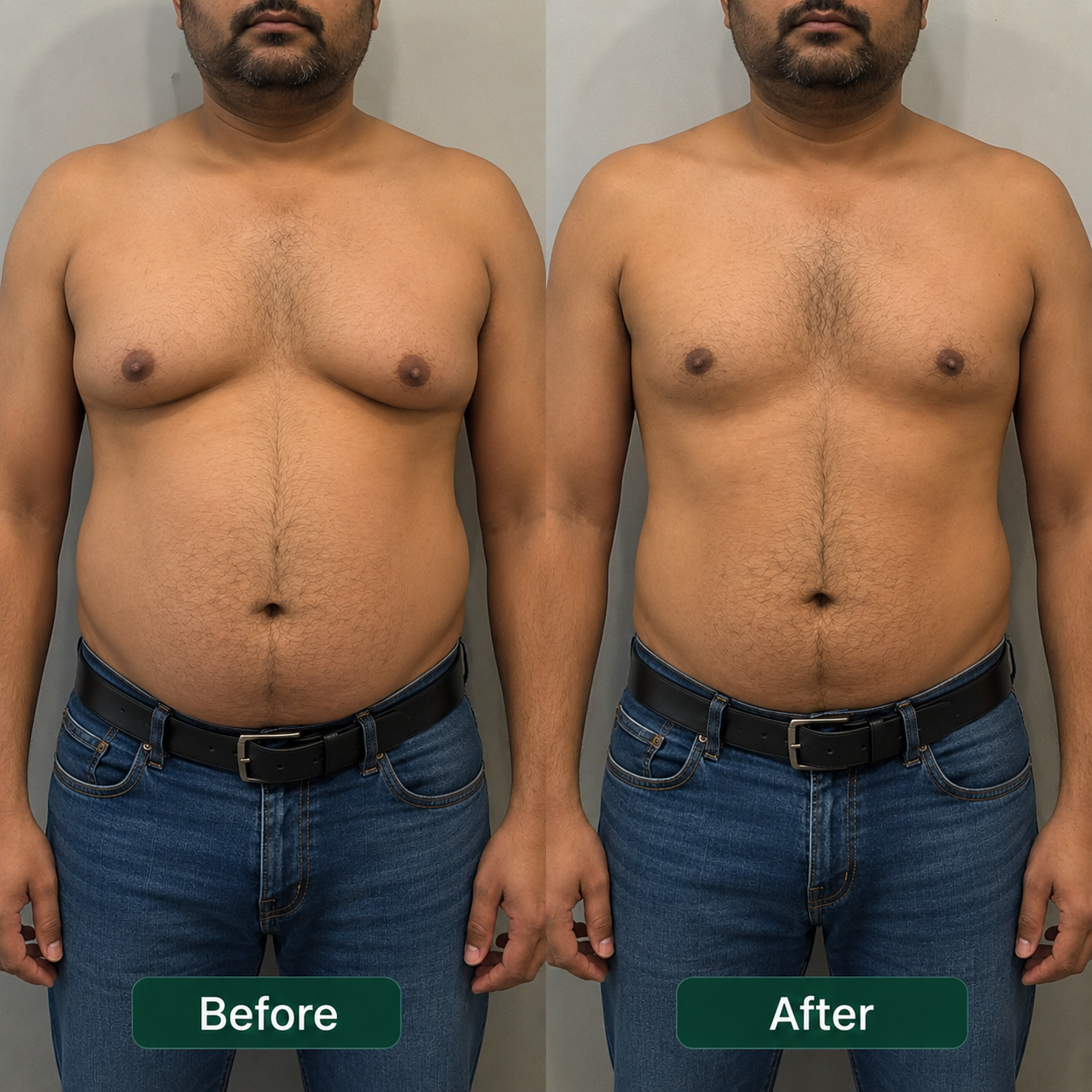 Rosalica Lymphatic Drainage Drops