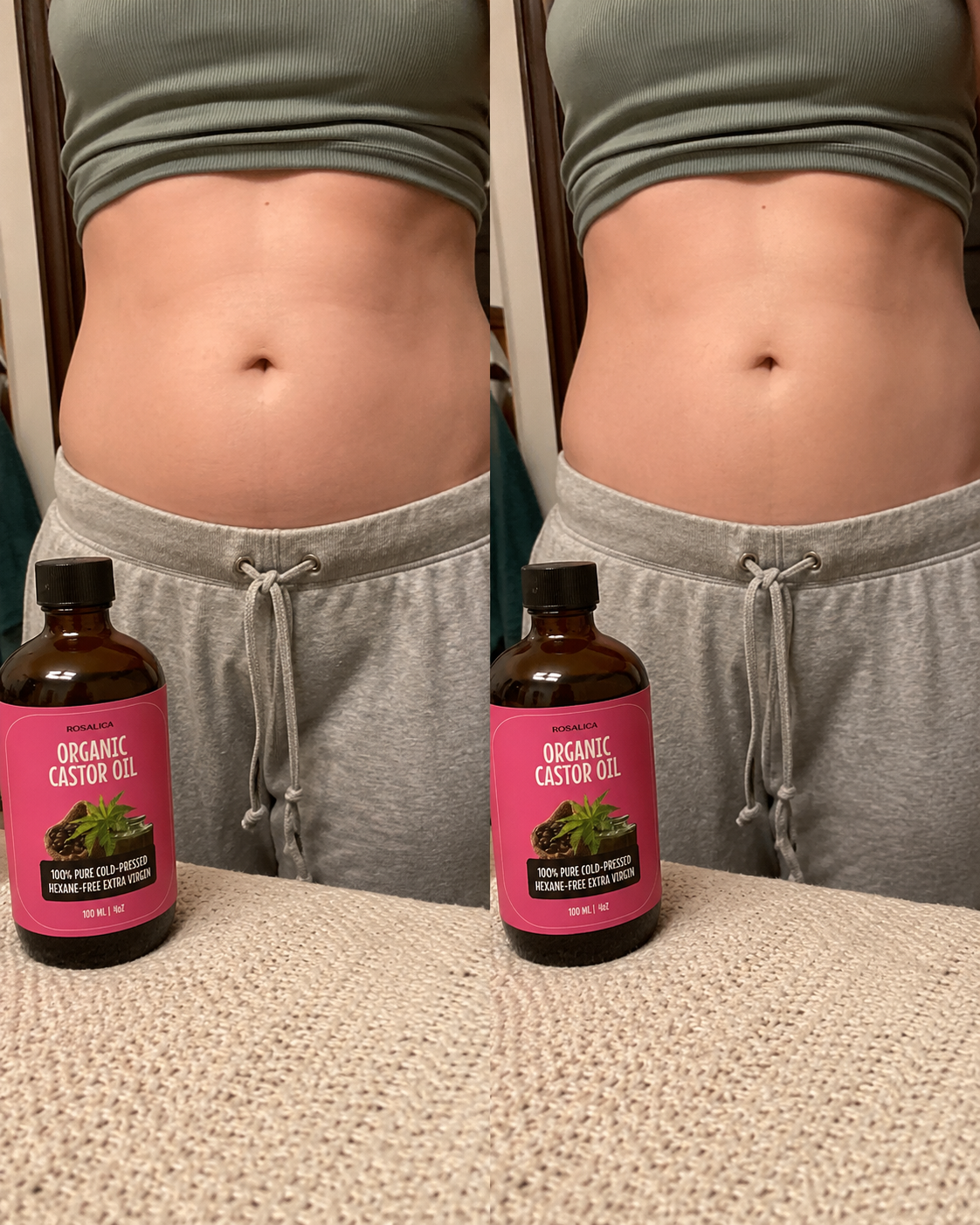 Customer using Rosalica Castor Oil Pack