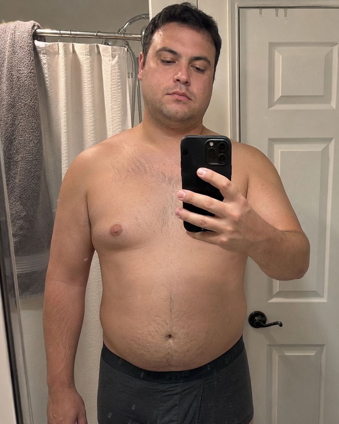 Before using Rosalica Lymphatic Drainage Drops for man boobs and face puffiness