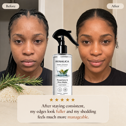 Rosalica Rosemary & Rice Water Hair Tonic