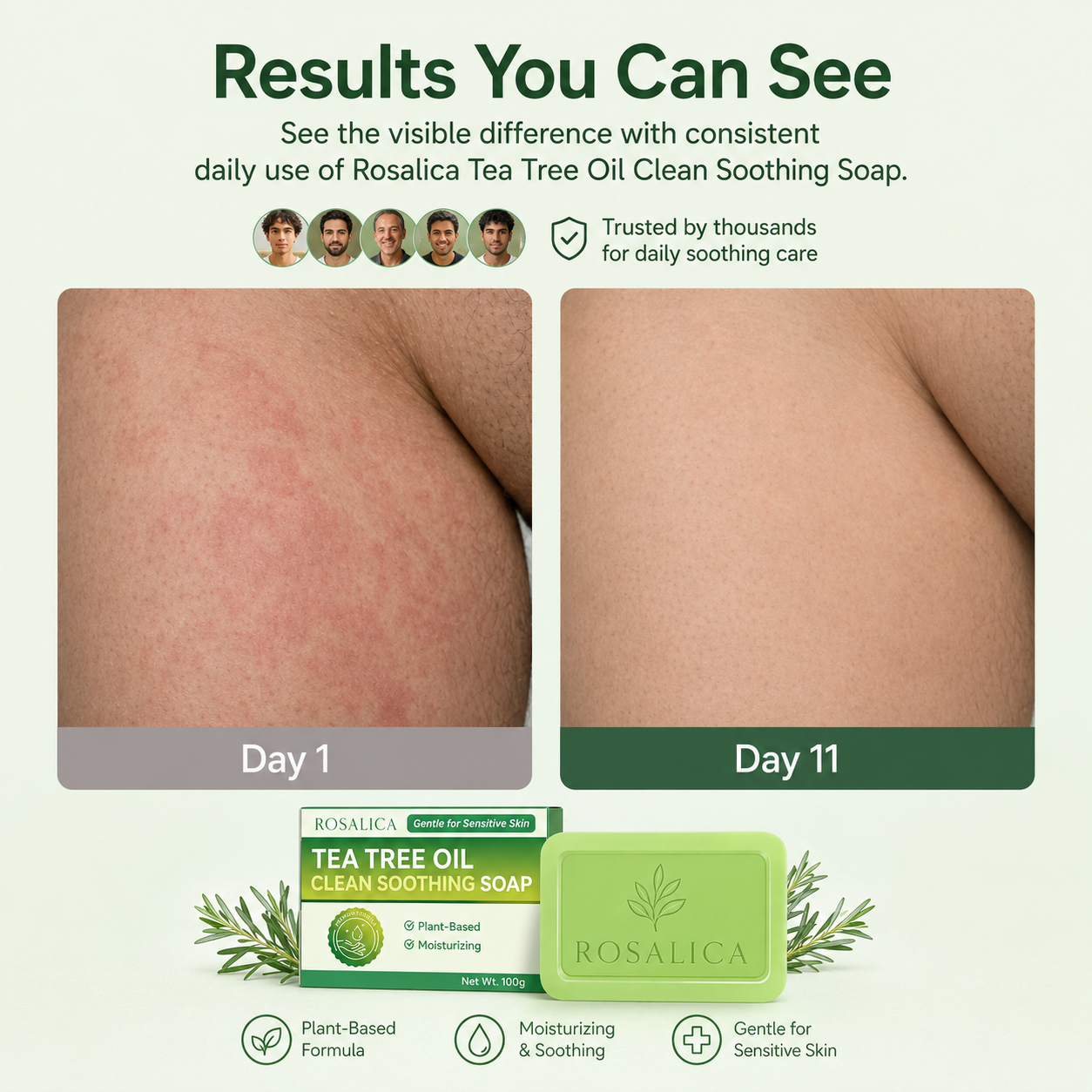 Rosalica Tea Tree Antifungal Soap