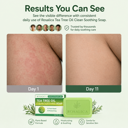 Rosalica Tea Tree Antifungal Soap