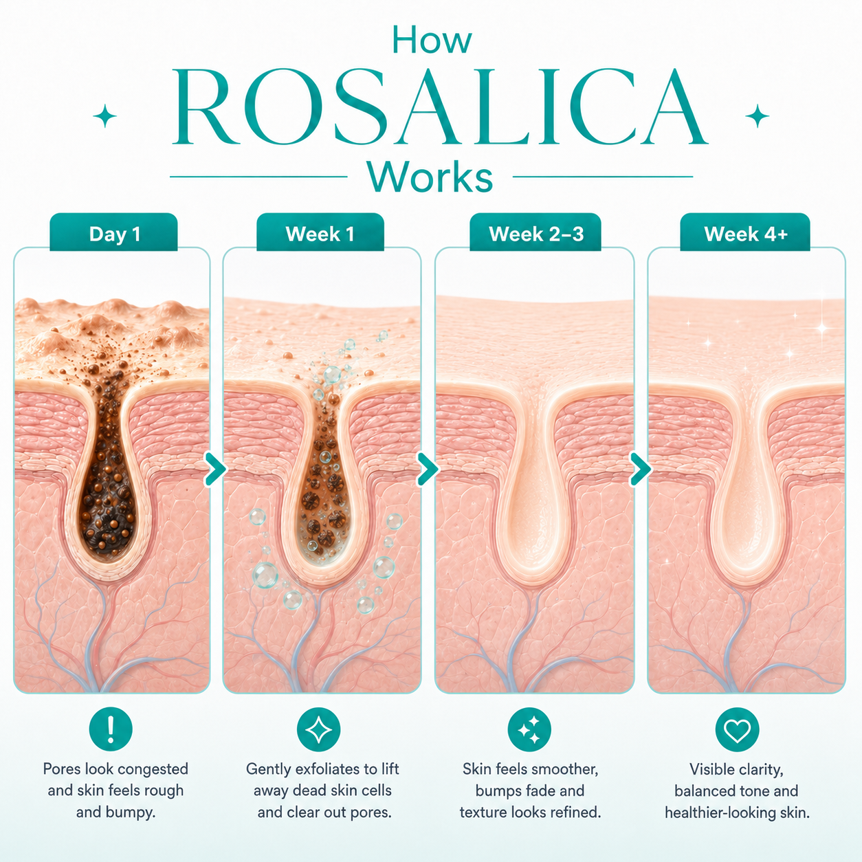 Rosalica™ Level 2 Mandelic Acid Serum