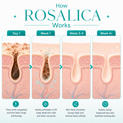 Rosalica™ Level 2 Mandelic Acid Serum