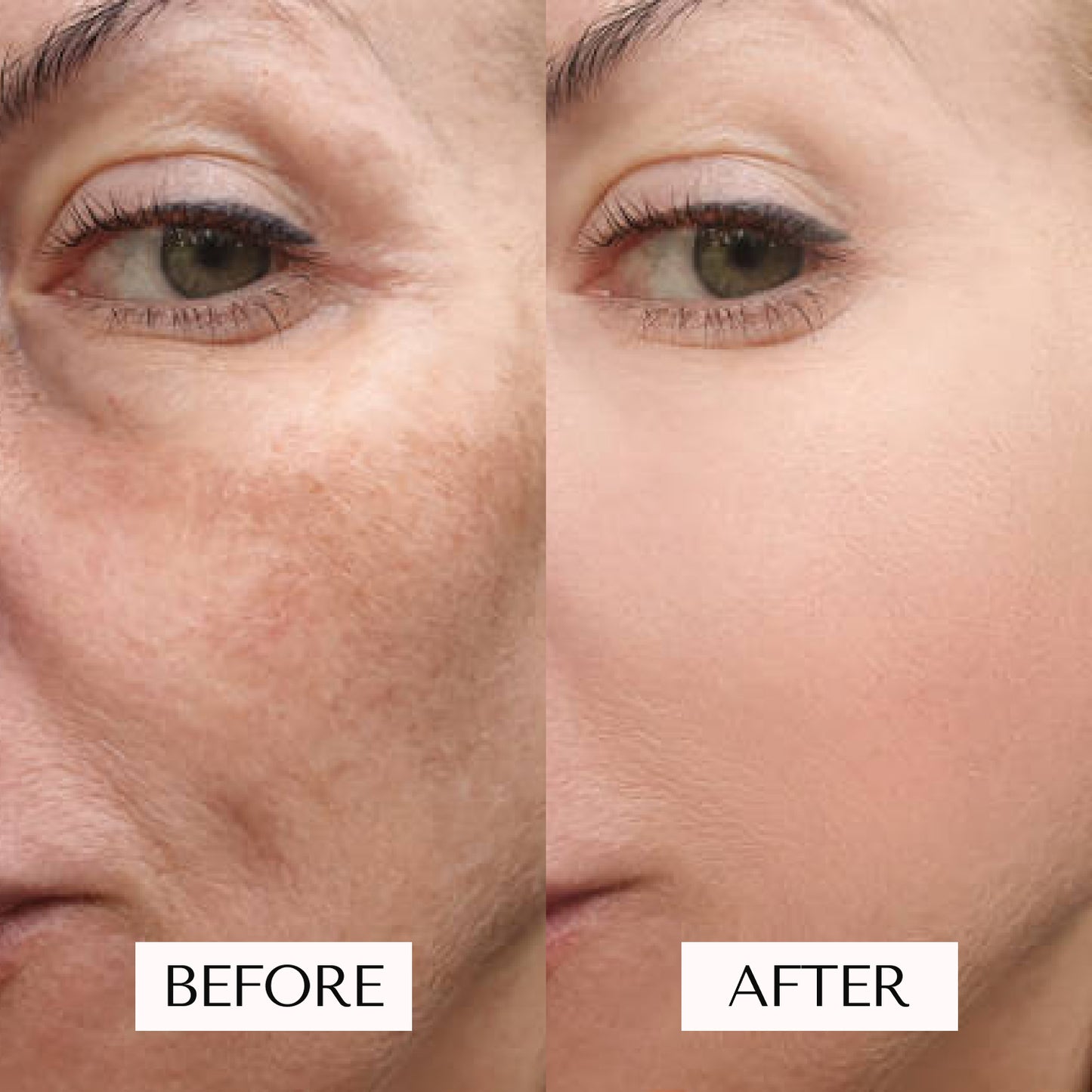 Red Light Therapy Mask