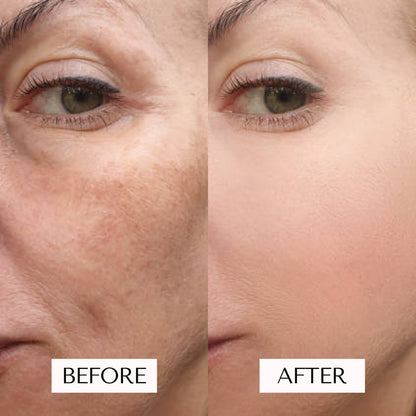 Red Light Therapy Mask