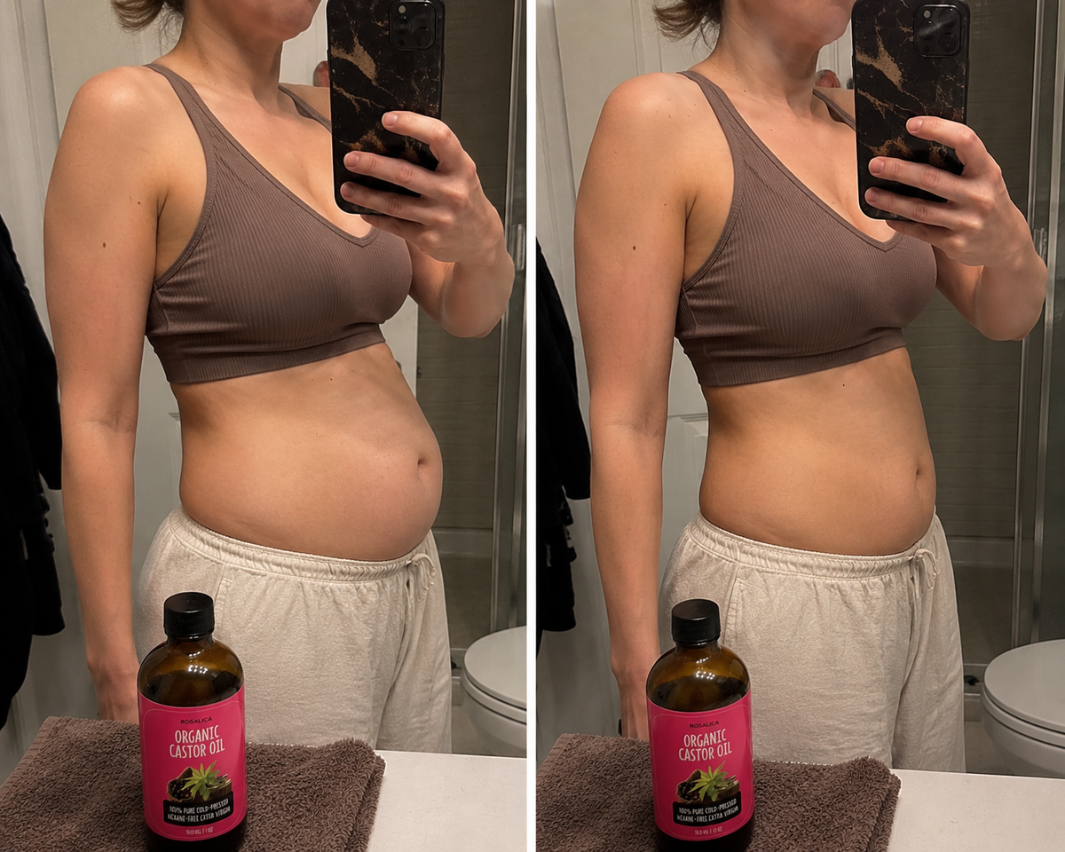 Customer using Rosalica Castor Oil Pack