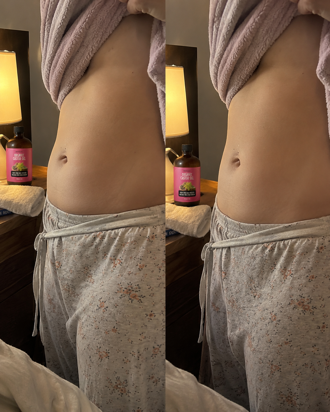 Customer using Rosalica Castor Oil Pack