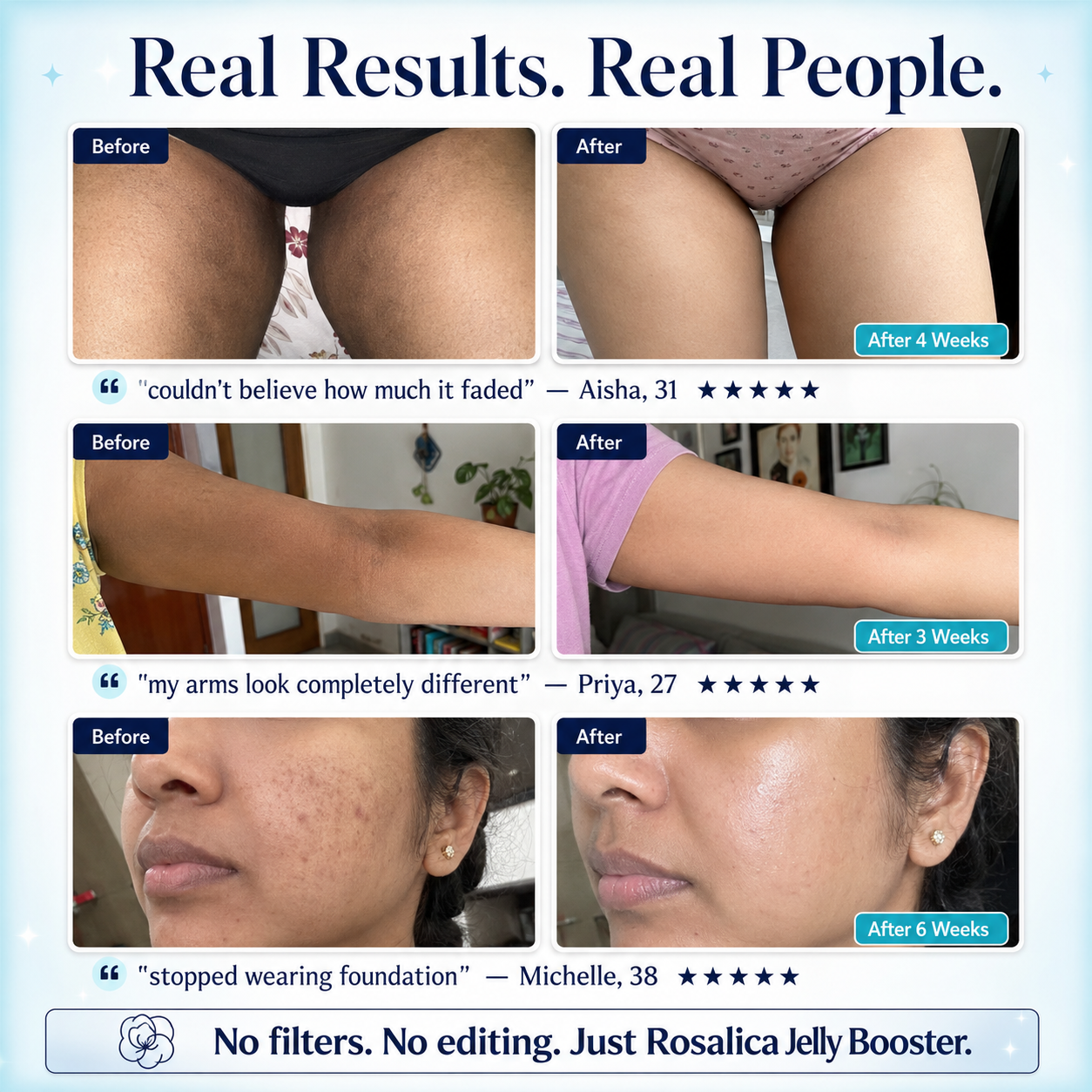 Rosalica™ Jelly Booster Pigment Recovery Body Lotion