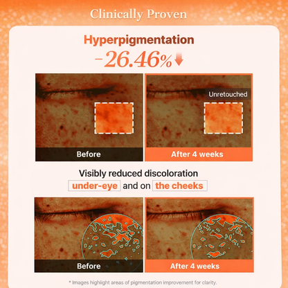 PDRN Collagen Hydrogel Eye Patches