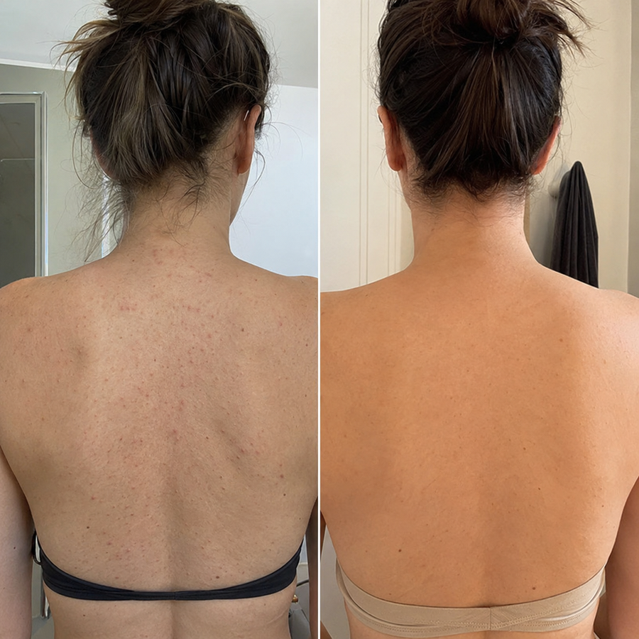 My back finally looked smooth.