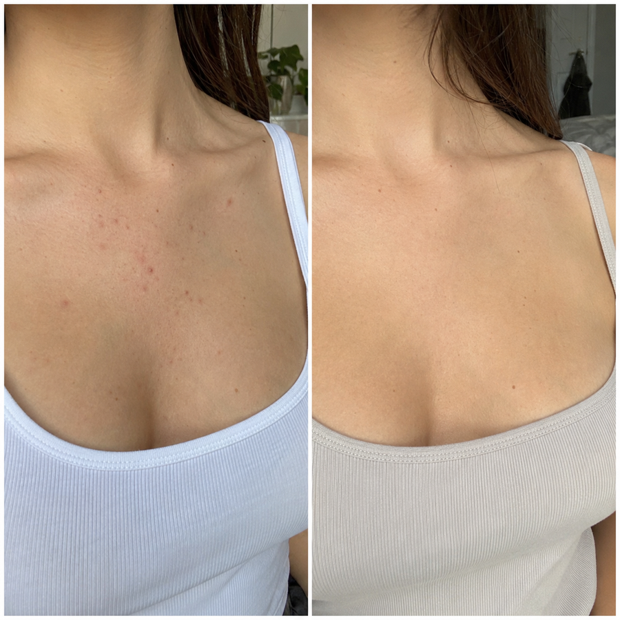 The marks started fading.