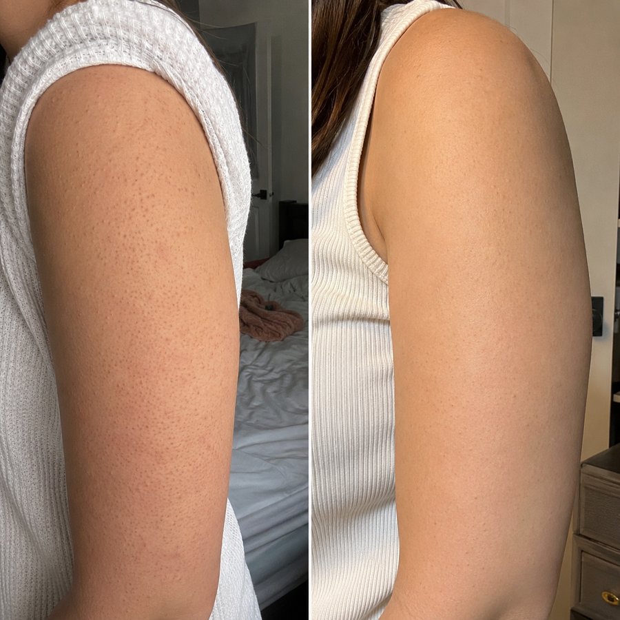My arms feel softer.